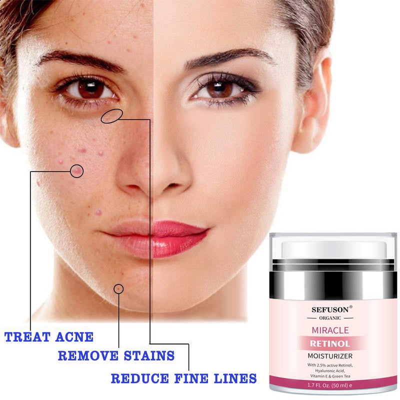 [Australia] - Retinol Moisturizer Cream,For Face&Eye Area Anti Aging Wrinkles & Acne & Fine Lines,with Vitamin E&Hyaluronic Acid & Jojoba Oil.Best Night&Day Facial Cream.With 2.5% Active Retinol,Face UV Protection 