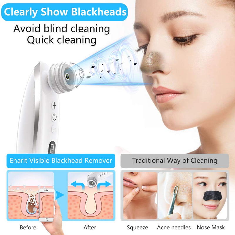 [Australia] - Blackhead Remover Vacuum, Visible Blackhead Remover With 5.0MP Camera -20x Microscope, Upgraded Pore Vacuum Cleaner 