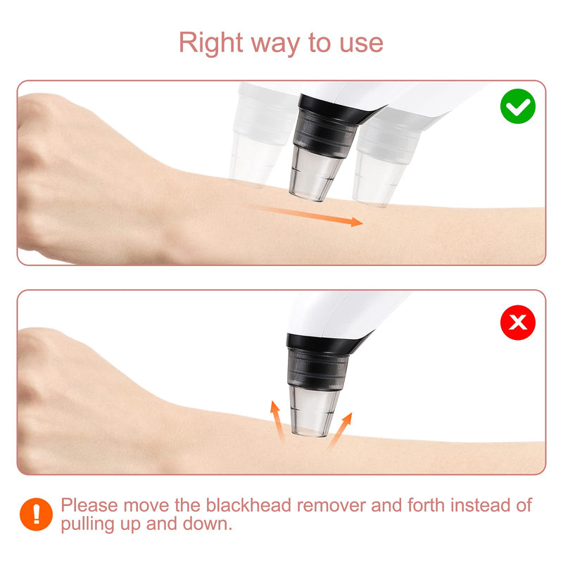 [Australia] - Boobeen Blackhead Remover - Electric Vacuum Pore with Hot Compress - USB Rechargeable Cleaner Extractor Tool with 3 Modes and 4 Suction Probes WB1 