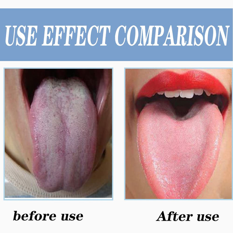 [Australia] - Tongue Scraper Stainless Steel, Tongue Cleaner, Fresh Breath Care Scraper, Great for Oral Care 