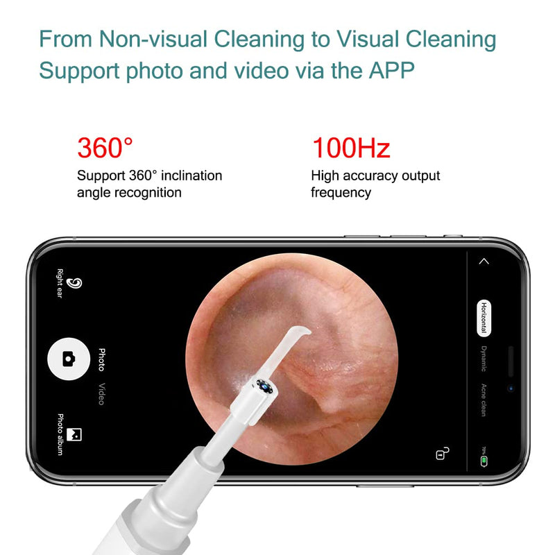 [Australia] - Ear Wax Removal Tool, Earwax Removal Kit with 1080p Fhd Camera Endoscope Otoscope 6 Led Lights, Wireless Connected, Compatible with iPhone, Ipad, Android Smart Phones & Table(White) White 
