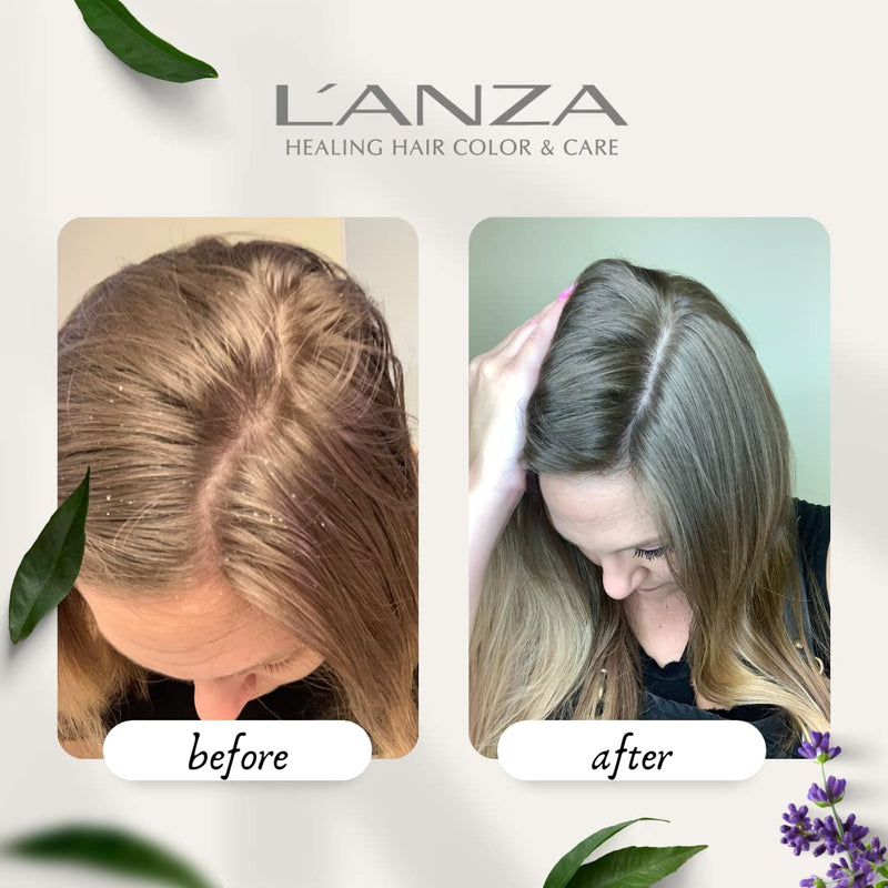 [Australia] - L'ANZA Healing Remedy Scalp Balancing Cleanser – Restores Wellness to Hair and Scalp while Reducing Oiliness and Excessive Sebum, with Papaya Extract, Sulfate-free, Paraben-free, Gluten-free 