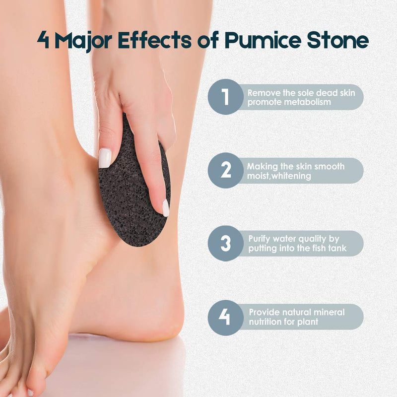 [Australia] - Vridale Pumice Stones for Feet Lava Pumice Stone Foot File Callus Removal Foot Scrubber for Hands Care Foot Exfoliation Dead Skin Remover with Handle 