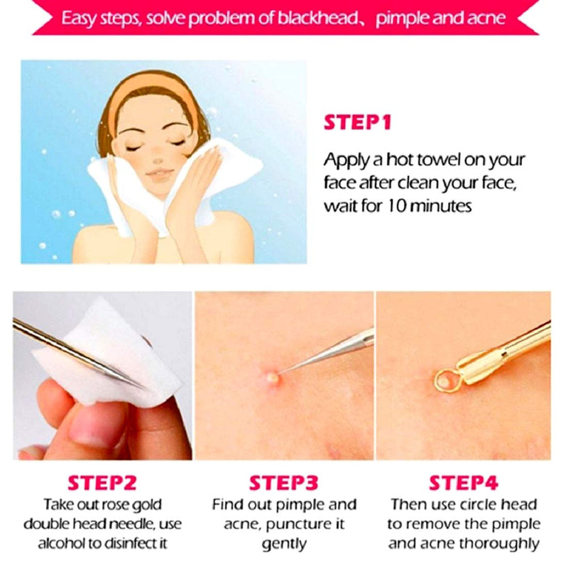 [Australia] - Blackhead Remover Pimple Comedone Extractor Tool Best Acne Removal Kit - Treatment for Blemish, Whitehead Popping, Zit Removing for Risk Free Nose Face Skin, Electroplated Best Seller 4 PCS w/case. 