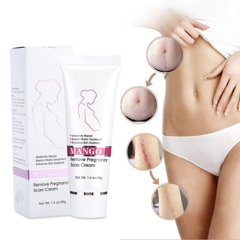 [Australia] - Anti-stretch marks postpartum to dilute stretch marks, repair abdominal moisturizing body cream, fat lines, eliminate obesity lines to tighten pregnant women's prevention products. Special skin care p 