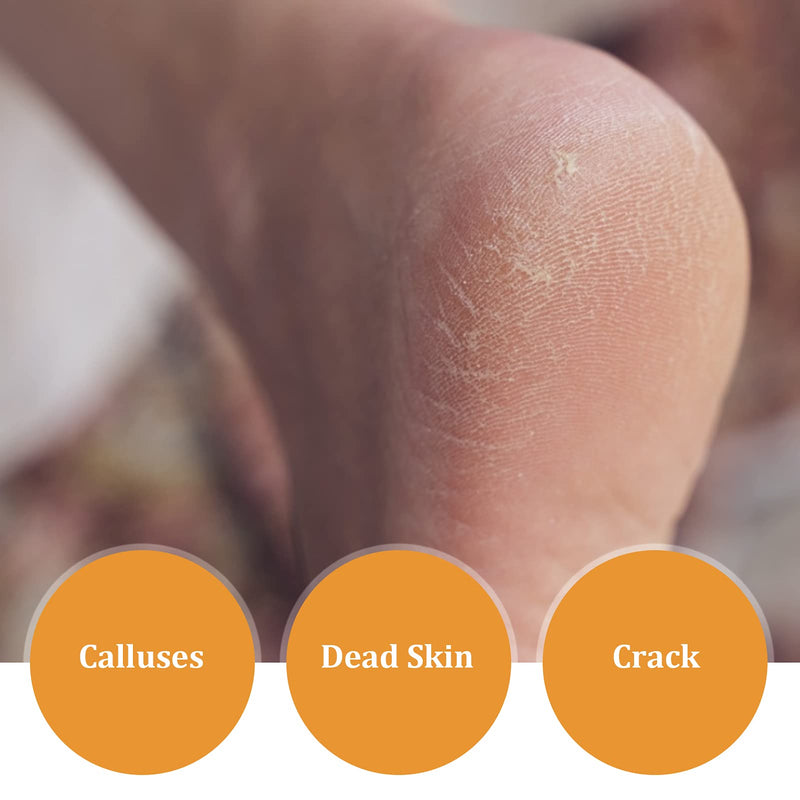 [Australia] - Nano Foot Scrubber, Professional Foot File Double‑Sided Glass with Nano-Level Grinding Points for Cracked Dry Skin for Dead Skin Removal for Wet and Dry Feet 