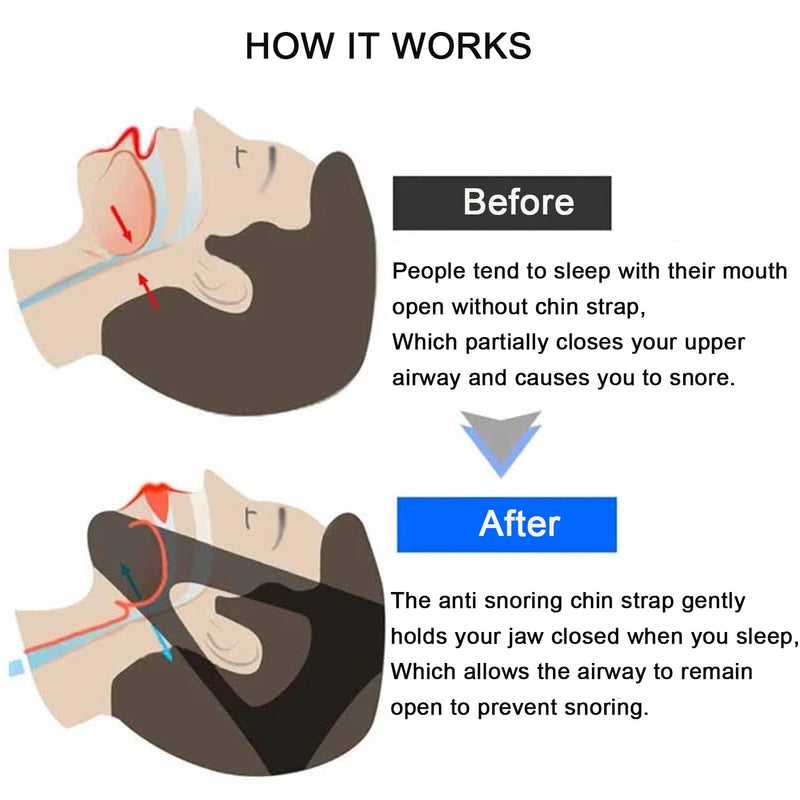 [Australia] - Anti Snoring Chin Strap Stop Snoring Aids Breathable Stop Snore Chin Strap Snoring Solution Snore Stopper Adjustable Anti Snoring Belt Stop Snoring Device for Men, Women, CPAP Users, Mouth Breather Black 
