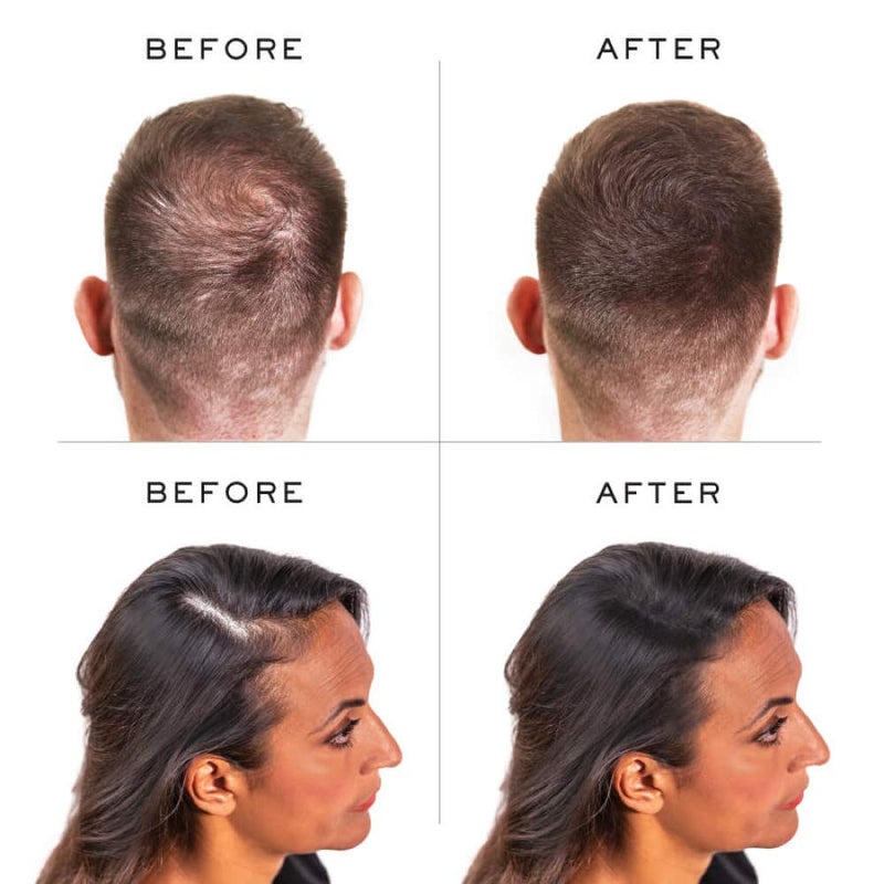 [Australia] - Nanogen Keratin Thickening Hair Fibres, 30 g, Dark Brown 30 g (Pack of 1) 
