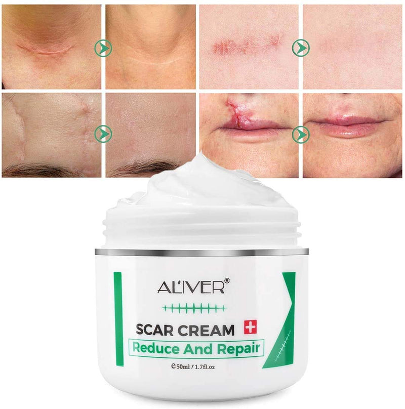 [Australia] - Scar Removal Cream for New Scars, Effective Stretch Mark Removal Natural Skin Repair Prevention of Insect Bites Scars, Face Skin Repair Gel for Men & Women 