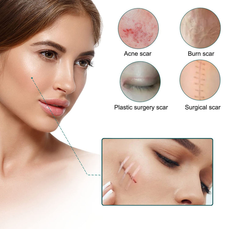 [Australia] - Silicone Scar Sheets, Silicone Sheet for Scar Removal, Gel Scar Repair Treatment Remover for Skin Fast Effective on Keloid Surgery Burn Acne C-Section Stretch Marks 