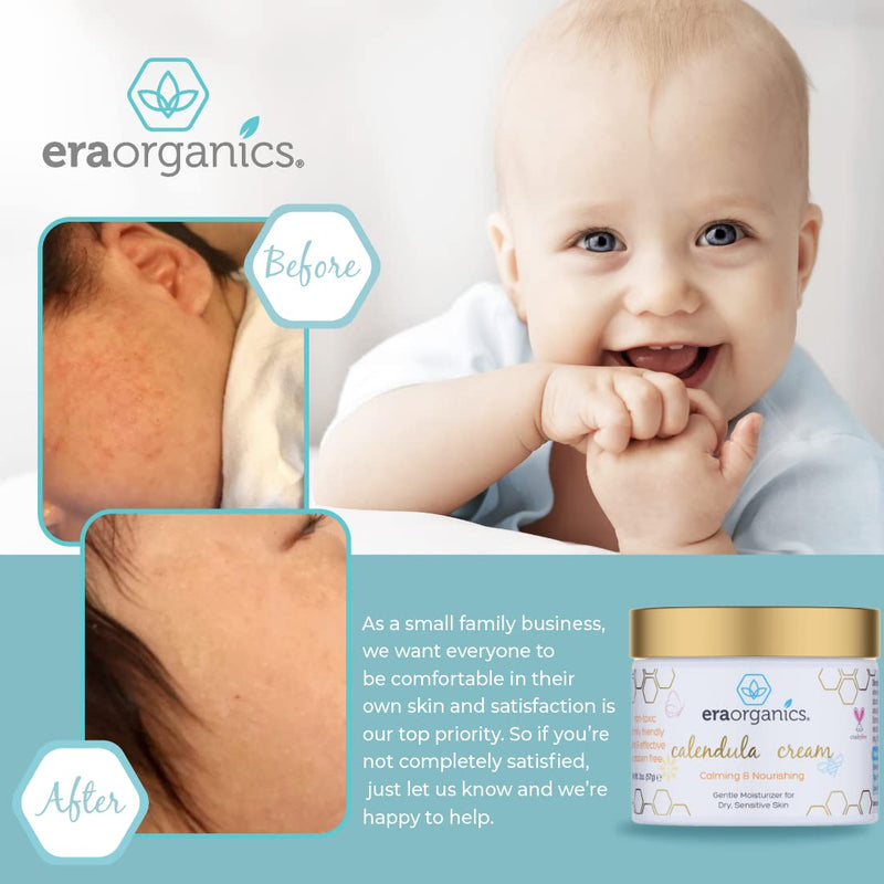 [Australia] - Era Organics Calendula Cream. Extra Soothing And Moisturizing Baby Lotion for Sensitive Skin Prone to Baby Eczema, Cradle Cap, Baby Acne, Rashes, Hives With Cocoa Butter, Rosemary, Zinc Oxide & More 