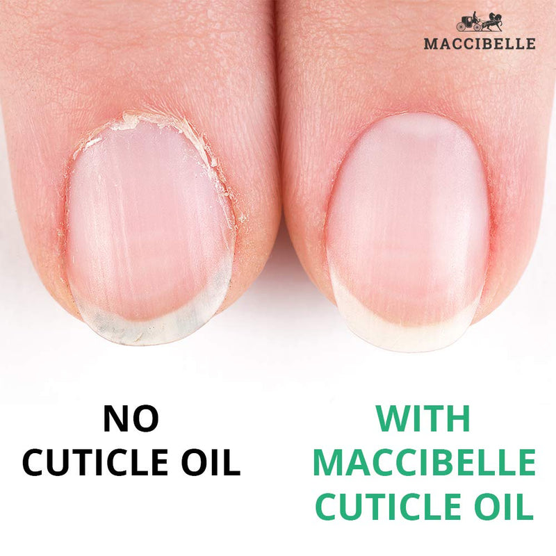 [Australia] - Maccibelle Cuticle Oil Pomegranate and Fig 0.5 oz Heals Dry Cracked Cuticles 