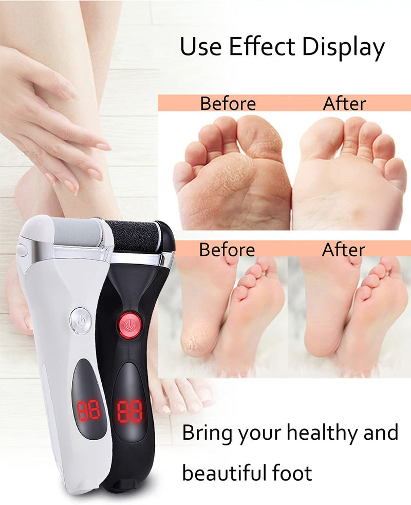 [Australia] - Jooayou Foot File Electric for Hard Skin, USB Rechargeable Waterproof Foot Scrub Callus Remover [with 3 Pumice Stone Rollers & 10 in 1 Foot Scraper Set] Foot Care Tool for Dry Dead Cracked Heel 15 Piece Set 