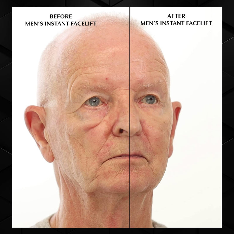 [Australia] - Beverly Hills Mens or Womens Instant Facelift and Eye Tuck Serum for Dark Circles and Puffy Eyes 