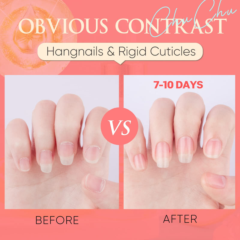 [Australia] - CHUCHU Cuticle Oil for Nails, 15ml, Jojoba Nail Cuticle Oil Contain Vitamin B & E, Moisturizes Cuticle and Nail's Skin, Strengthens Nails, Prevents Hangnails and Chapped, Cherry 