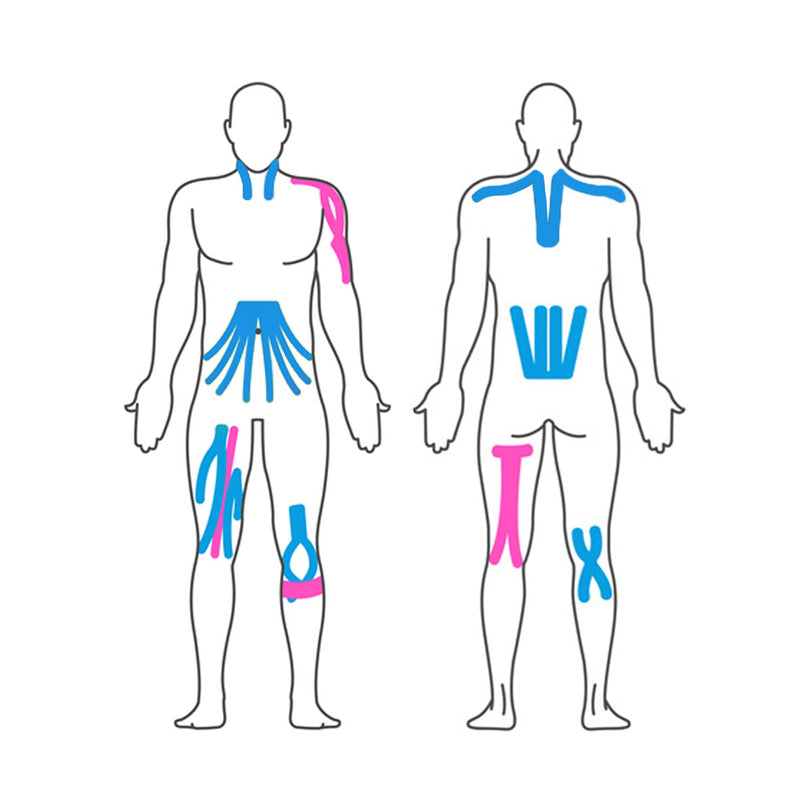 [Australia] - Effekt Manufaktur Kinesiology Tape Waterproof (16 ft x 2 in), 2 Rolls - Elastic Physio Tape for Muscle Support and Injury Recovery, Medical Tape, Kinetic Tape, Durable Kinesthetic Tape (Blue + Pink) Blue + Pink 