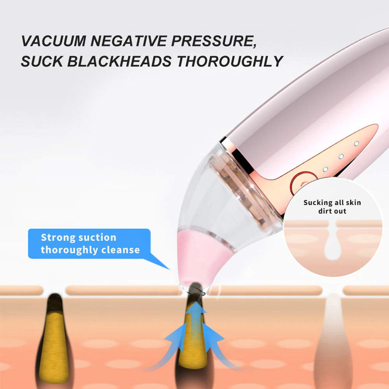 [Australia] - Blackhead Remover Vacuum with 4 Silicone Suction Heads by Scienbeauty Facial Pore Vacuum Cleanser Skin Care Electric Acne Comedone Extractor Kit for Women And Men Black Heads Extraction 