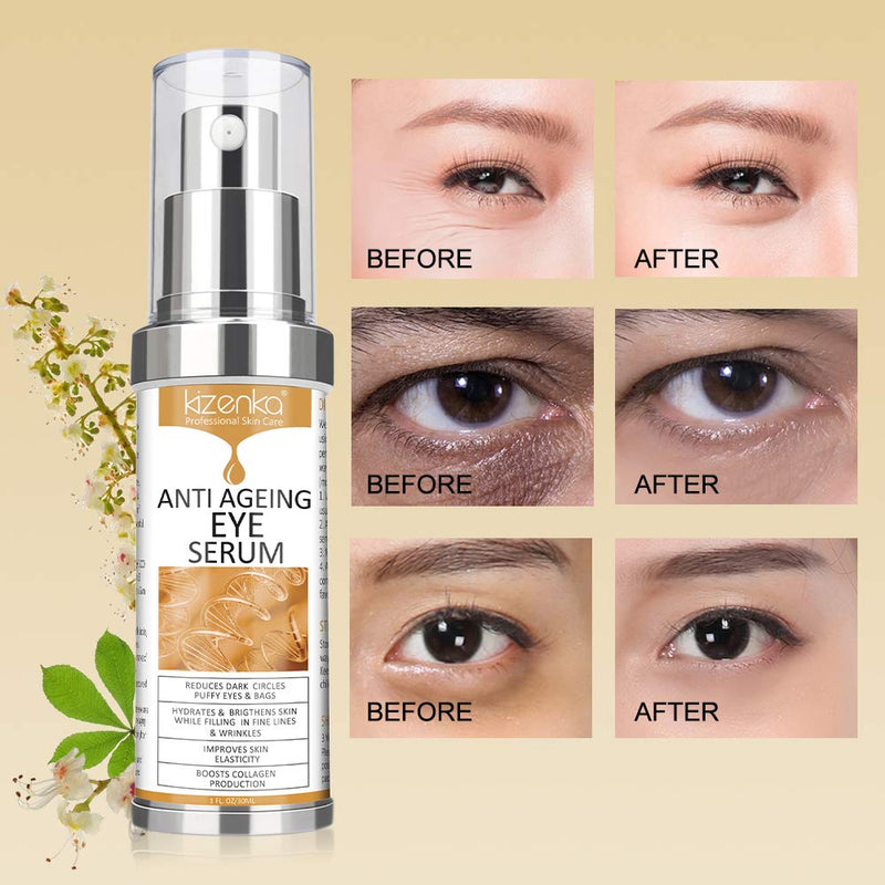 [Australia] - kizenka Eye Serum, Anti Ageing Eye Cream for Dark Wrinkles with Natural Ingredients for Dark Circles, Remove Dark Circles Eye Care Against Puffiness and Bags 