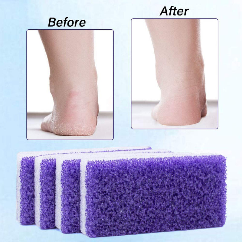 [Australia] - 4 Pack Foot Pumice Stone 2 in 1 Double Side PU Pedicure Stone Dead Hard Skin Callus Scrubber Remover Tool for Smooth Feet and Hands (Purple) Purple 