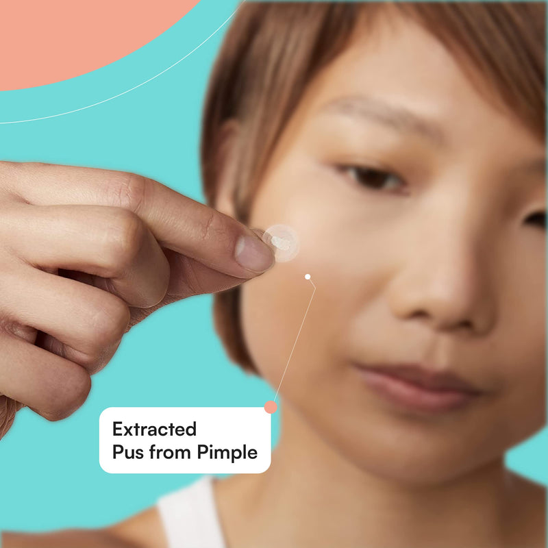 [Australia] - Breakout Pimple Acne Spot Patches by SKINCHOICE - 30 Invisible Hydrocolloid Mighty Patch, Dots for Blemish Spots Treatment For Face, Zit Stickers, Vegan & Cruelty-Free Skin Care 30 Count (Pack of 1) 