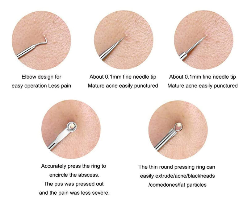 [Australia] - 4PCS Blackhead removal tool kit. Four-piece with storage box for nose facial care silver 