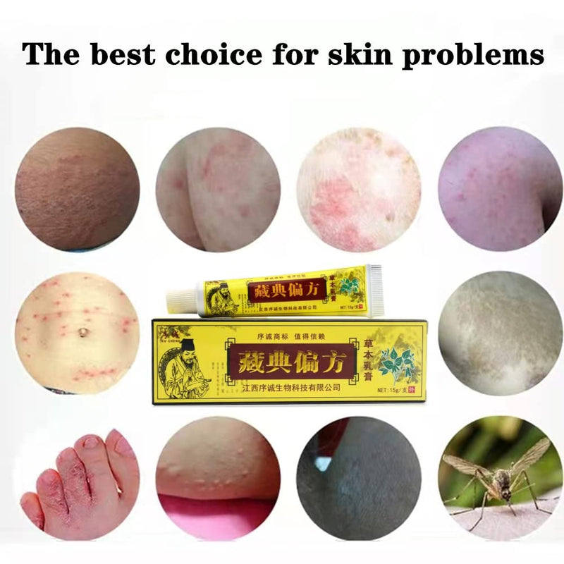 [Australia] - 4pcs Natural Chinese Herbal Eczema Psoriasis Cream Dermatitis Pruritus Ointment External Anti-Itch Dermatitis Inflammation and Rashes Defeon New Face Cream Body Cream CEZUBEM Creams(4pcs) 4 