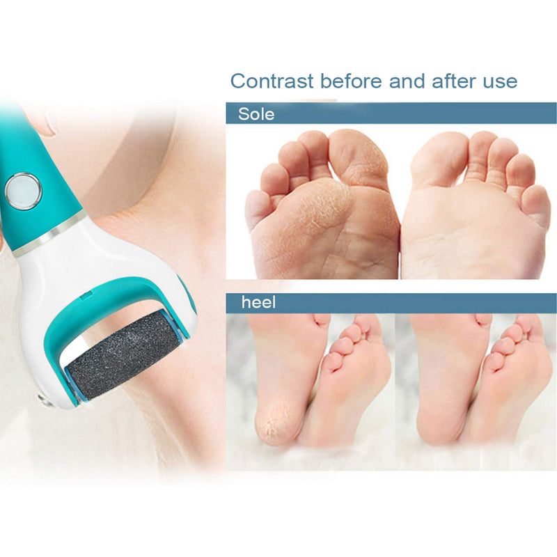 [Australia] - 9Pcs Pedi Replacement Rollers Heads Refills, 5 Extra Coarse and 4 Regular Coarse for Hard Skin Remover 5 Extra Coarse+4 Regular Coarse 