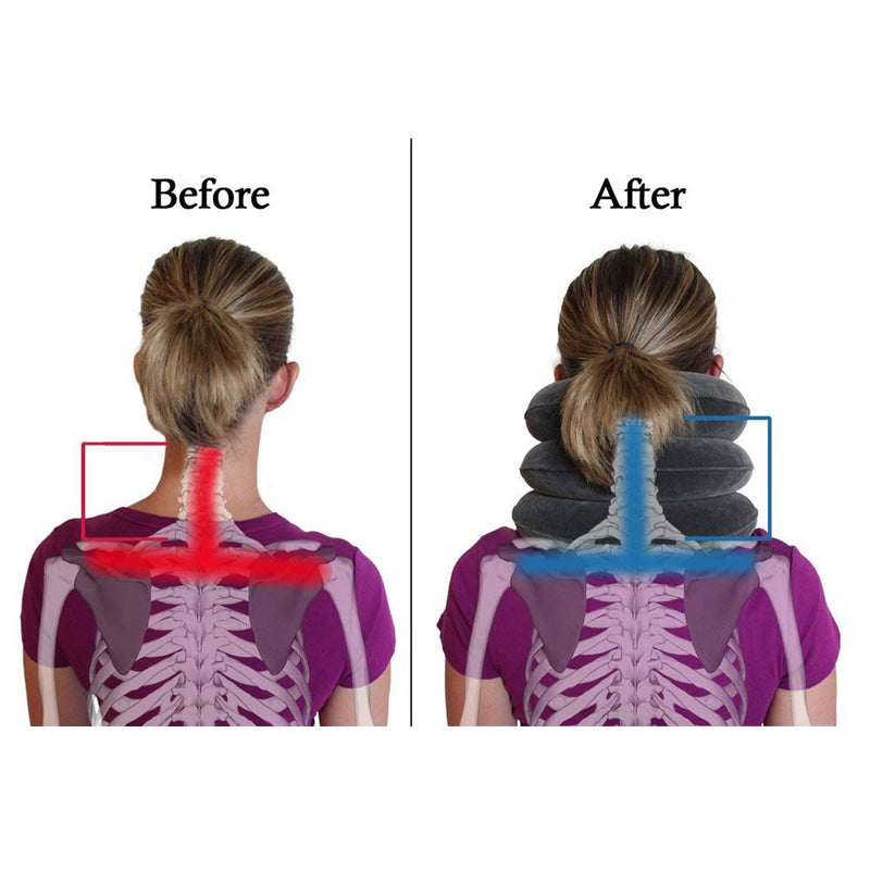 [Australia] - TEEROVA Cervical Neck Traction Collar Device Inflatable Spine Alignment Pillow Instant Pain Relief for Chronic Neck and Shoulder Pain (Gray) Gray 