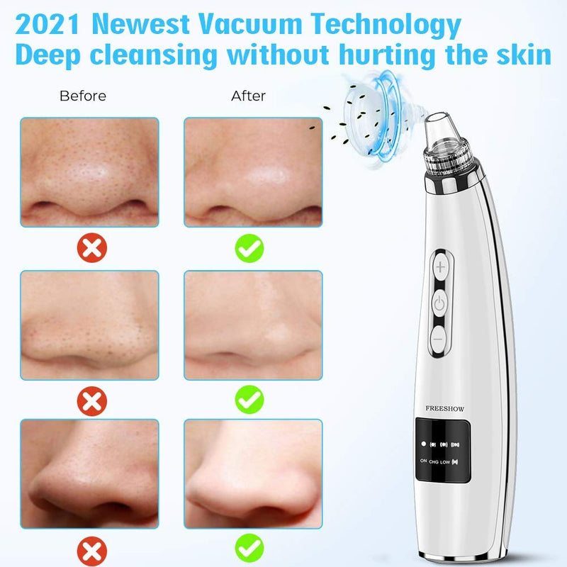 [Australia] - 2021 Newest Blackhead Remover Vacuum Pore Cleaner, Electric Acne Comedone Whitehead Extractor with 5 Suction Power & 5 Probes, USB Rechargeable, Blackhead Pore Vacuum for Women & Men Black 