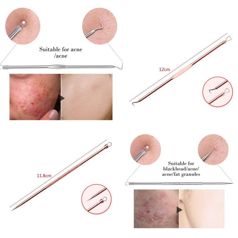 [Australia] - Blackhead Remover Pimple Comedone Extractor Tool Best Acne Removal Kit - Treatment for Blemish, Whitehead Popping, Zit Removing for Risk Free Nose Face Skin with Case (ROSE) ROSE 