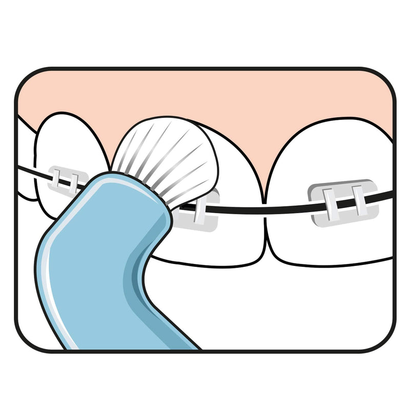 [Australia] - TEPE Compact Single Tuft Brush for Precision Cleaning of Difficult Areas, Such as Braces, Gum line and implants - 1 x TEPE Compact Brush (Pack of 2) 1 count (Pack of 2) 