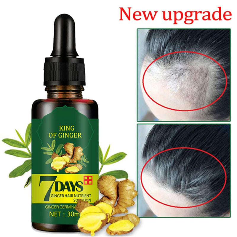 [Australia] - Hair Growth Serum, Hair Care Product, Hair Serum, Fast Hair Growth, Hair Growth & Hair Thickening,Stop Hair Loss, Grow Hair Fast, Hair Loss Treatment for Men & Women(30ml) 