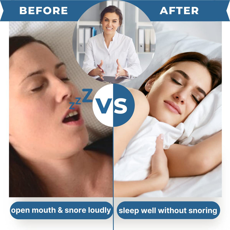 [Australia] - Orapink Anti Snoring Chin Strap, Breathable Adjustable Anti-Snoring Stop Snoring Chin Strap, Neoprene Anti-Snoring Stop Snoring Chin Strap, Anti Apnea, Suitable For Men Women And Kid 