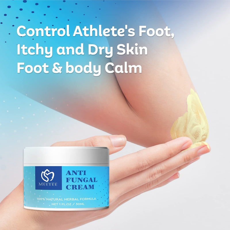 [Australia] - Antifungal Cream, Anti Fungal Skin Cream Helps Eczema, Ringworm, Jock Itch, Athletes Foot, Anti-Itch Balm for Face & Body, Gentler and Safer 