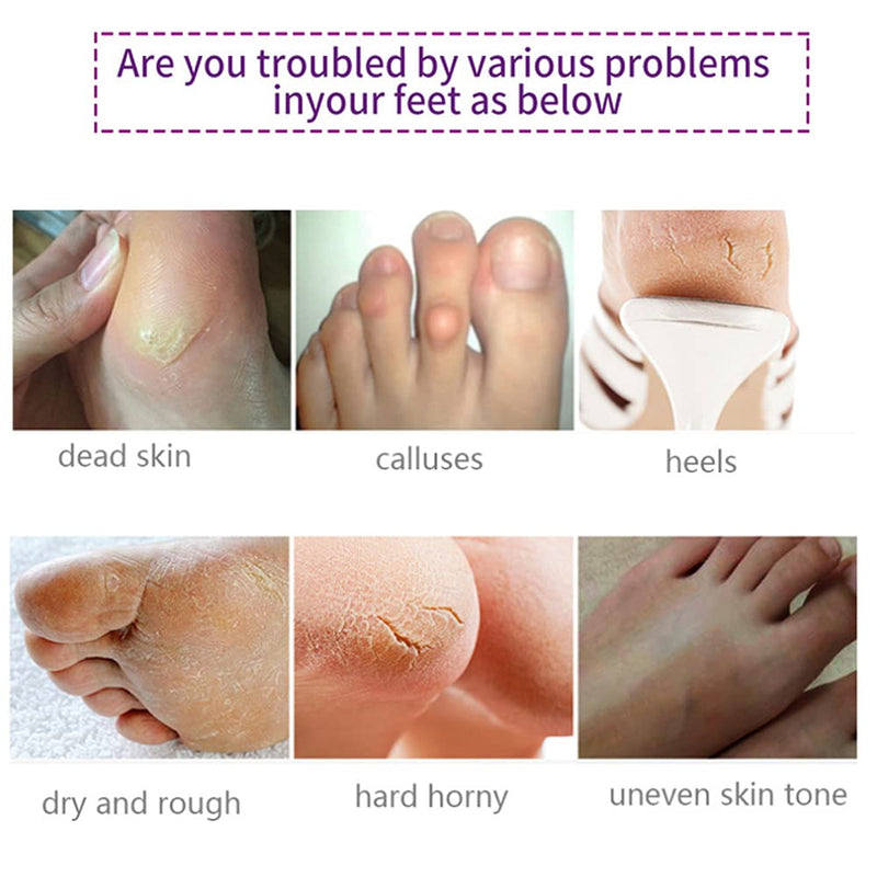 [Australia] - Foot Peel Mask 5 Pack, Lavender Exfoliating Foot Masks, Natural Exfoliator for Dry Dead Skin, Callus, Repair Rough Heels for Men Women 