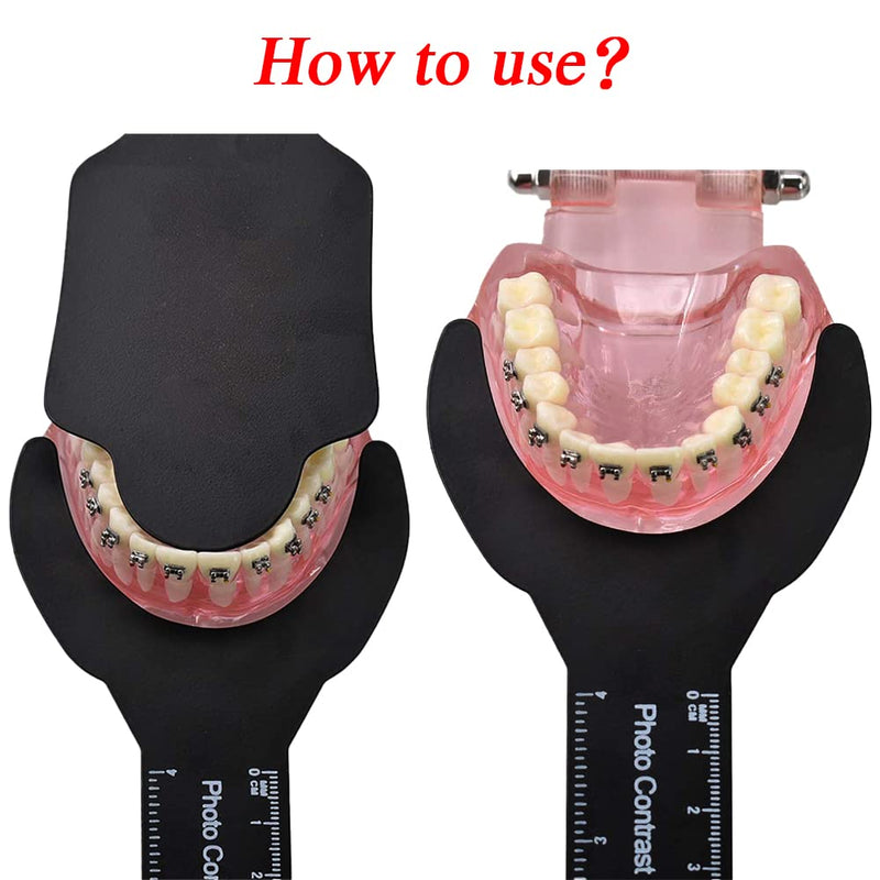 [Australia] - 6 Pcs Dental Photography Contraster, 6 Size Black Background Board Dental Photo Contrast Kit, for Palatal Photo Contrast 