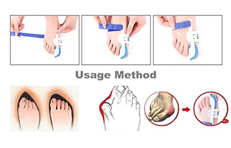 [Australia] - Careforyou® Night Time Splint Big Toe Straightener Bunion Hallux Valgus Corrector Regulator Stretcher Support Separators Foot Care Pain Relief 