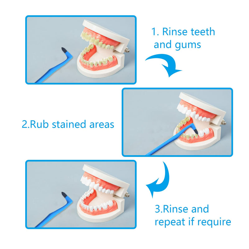 [Australia] - NITAIUN 5 Pieces Remover Tooth Cleaning kit, Teeth Stain Eraser Teeth Polishing Cleaning Kit Whitening Cleaning Eraser Oral Hygiene Care Tool 