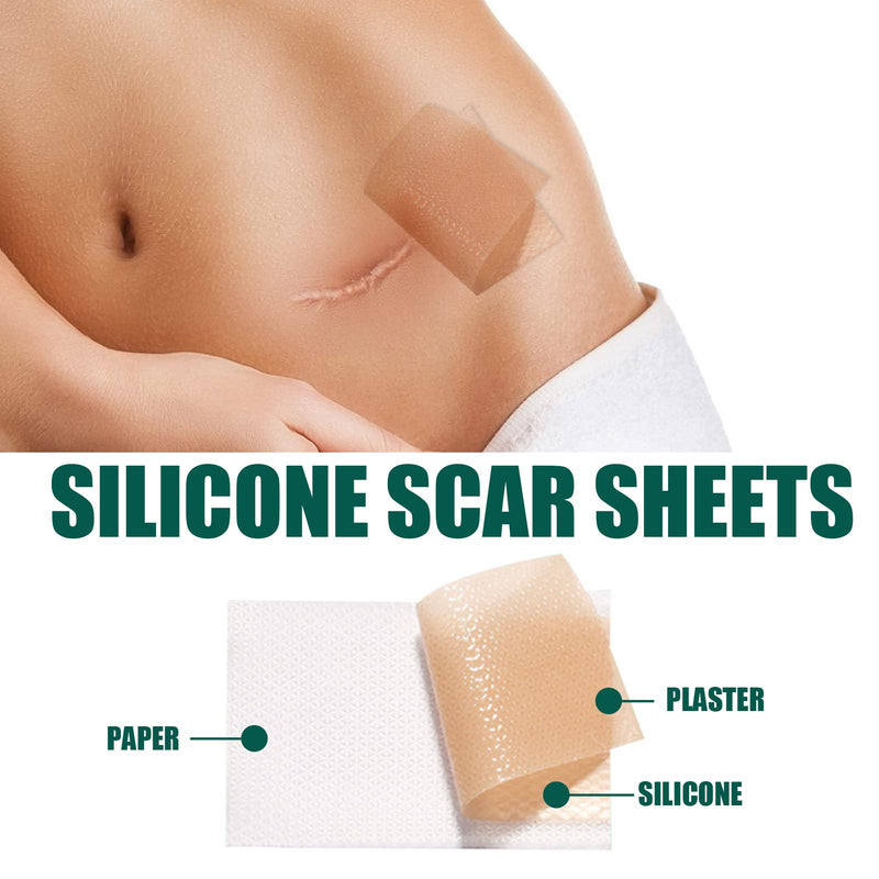 [Australia] - 59in Silicone Scar Sheets, Self Adhesion Reusable Scar Removal Gel Tape for C Section, Post Surgery, Burns, Acne 