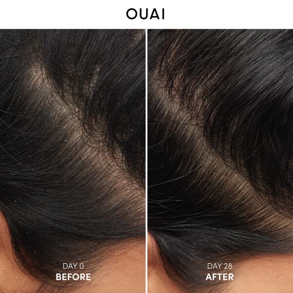 [Australia] - OUAI Anti-Dandruff Shampoo with Salicylic Acid. Gentle Hair Cleanser for Flaky and Dry Scalp. Reduce Itching, Redness, and Irritation (10 Fl Oz / 300ml) 