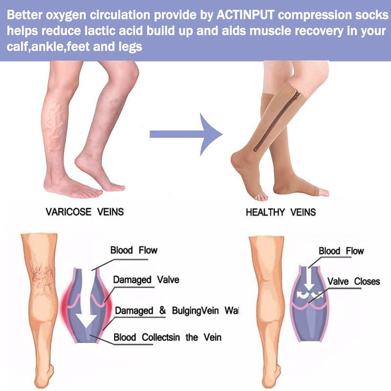 [Australia] - 2 Pairs Compression Socks Toe Open Leg Support Stocking Knee High Socks with Zipper Large-X-Large 01-nude 