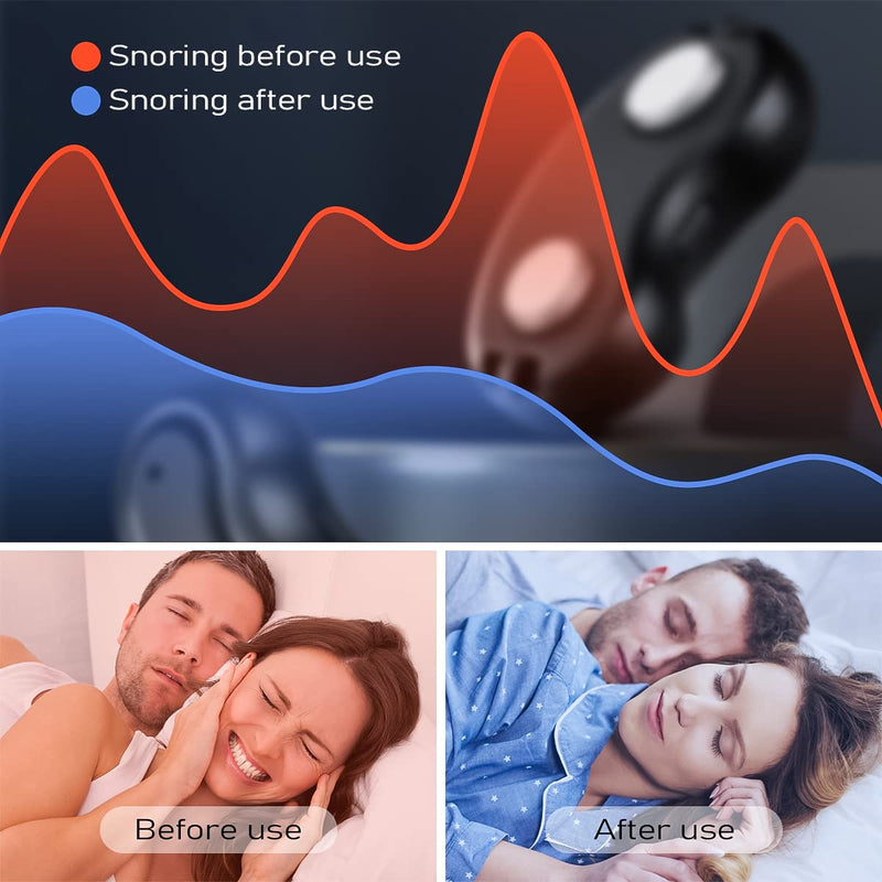 [Australia] - Anti Snoring Devices, New Snore Smart Stopper, Snoring Detection by Impulse Sense, Snore Reducing Aids for Men and Women 