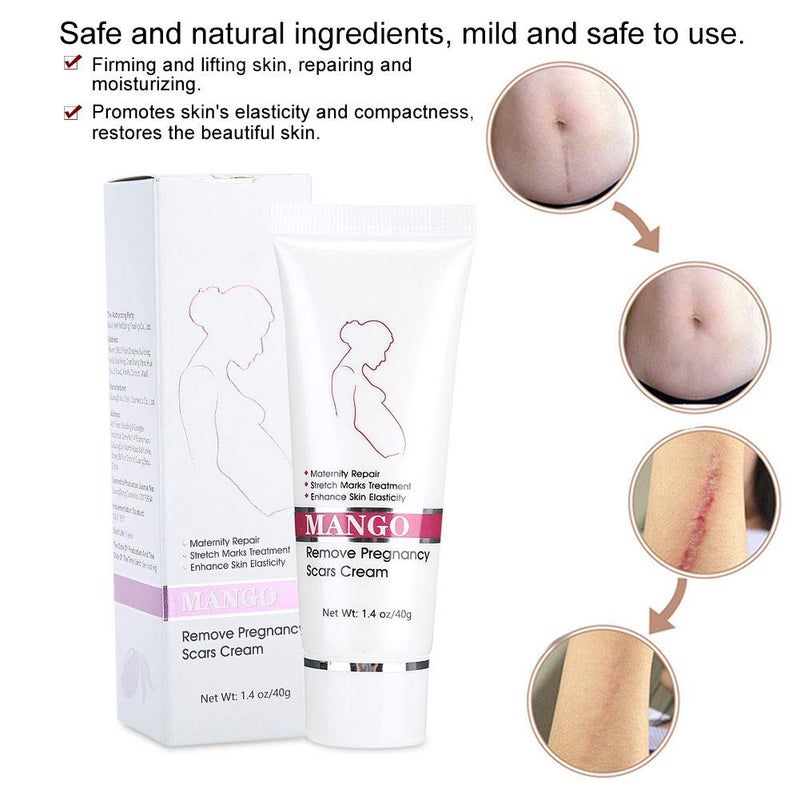 [Australia] - Anti-stretch marks postpartum to dilute stretch marks, repair abdominal moisturizing body cream, fat lines, eliminate obesity lines to tighten pregnant women's prevention products. Special skin care p 