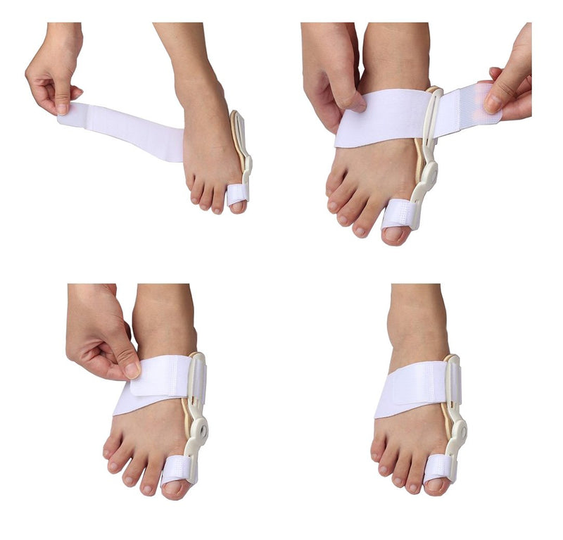 [Australia] - VIEEL1 Pair Bunion Device Hallux Valgus Orthopedic Braces Toe Correction Foot Care Corrector Thumb Big Bone Orthotics Toe Separators Toe Straightener (White) 