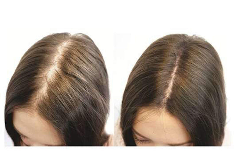 [Australia] - 100% Natural Keratin Hair Fibre Refill For Hair Loss - Alopecia & Chemotherapy (100g, Black) 100 g (Pack of 1) 