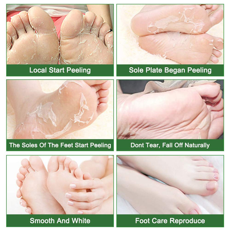 [Australia] - Foot Peel Mask - 5 Pack of Tea Tree Foot Mask - Removes Calluses,Dead and Dry Skin - Repairs Rough Heels, Foot Peeling Mask for Women and Men 