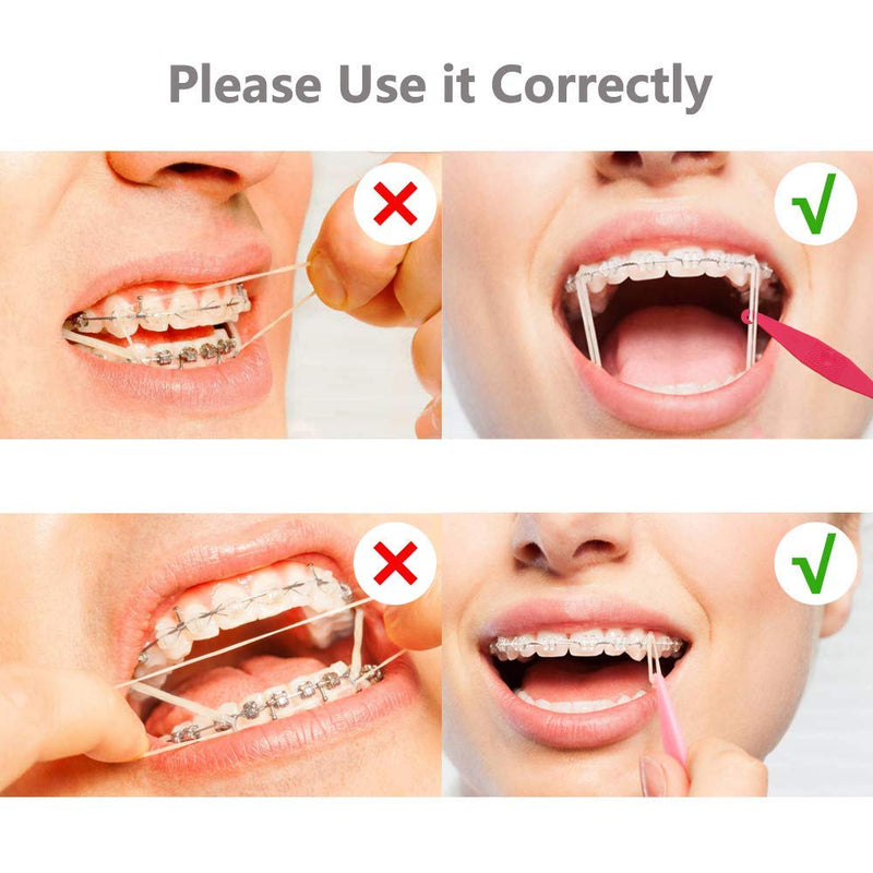 [Australia] - Amber 1/4 Medium Strength 3.5oz Orthodontic Elastic Braces Rubber Dental Bands 2 Pack (200 piezas) 2 Pack (200 piezas) 