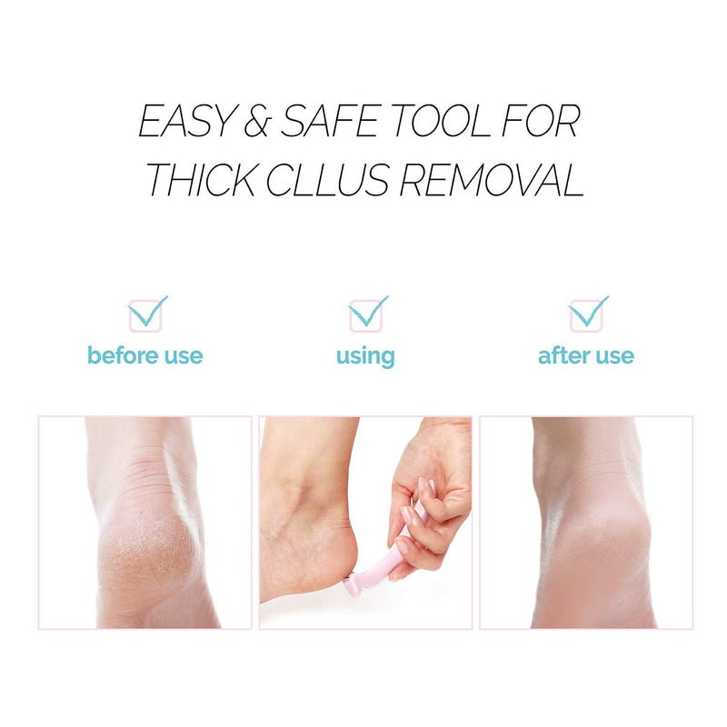 [Australia] - F3 Systems Callus Razor, Pedicure Tool, Effective for Cracked Heel, Ergonomic Design for Easy Grip, Safety Stainless Steel Callus Shaver, Blade for Foot Care, Hard, Rough, Thick Callused Skin Remover 1 Count (Pack of 1) 
