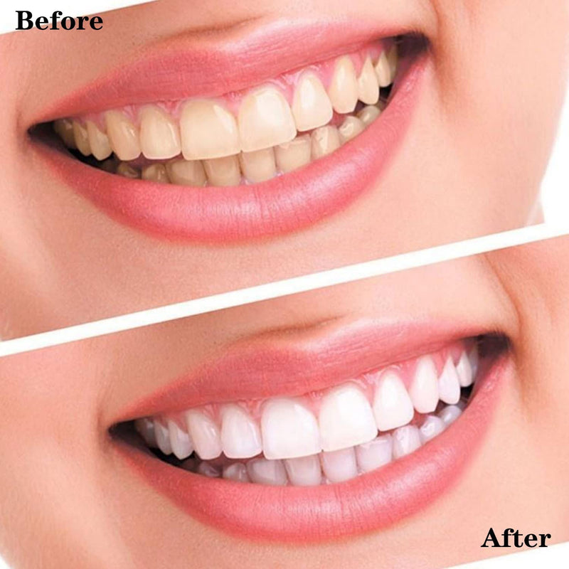 [Australia] - Teeth Whitening Strips, Elastic Gel Non-Sensitive Teeth Whitening Kit, Whitening Strips for Against Yellow Teeth, Smoke Stains, Black Teeth Blue 