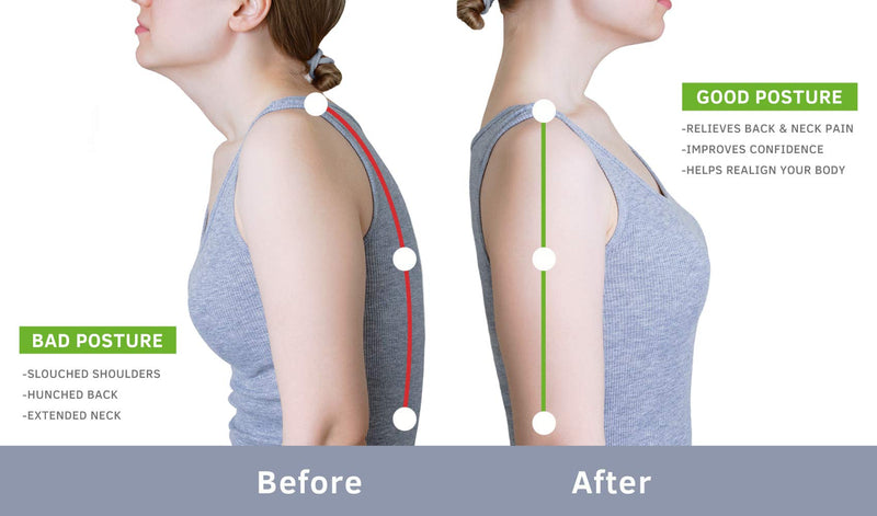 [Australia] - Beibye- Upper Back and Headache Pain Relief - treatment for Costochondritis and Tietze Syndromeb-Help Back Stretcher, Posture Corrector 